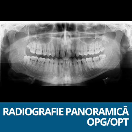 radiografie panoramica opg
