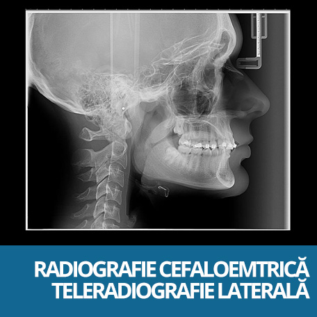 radiografie cefalometrica