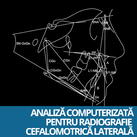 analiza computeriata pentru radiografie cefalometrica laterala