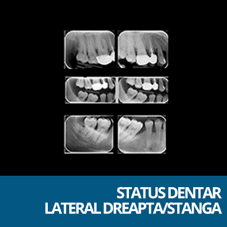status dentar lateral