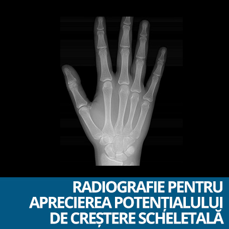 radiografie apreciere potential crestere scheletala