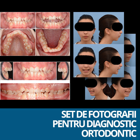 set de fotografii diagnostic ortodontic