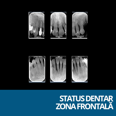 status dentar zona frontala