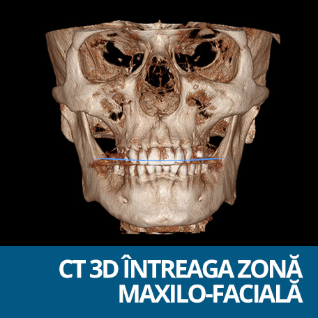 tomografie 3d maxilo-faciala