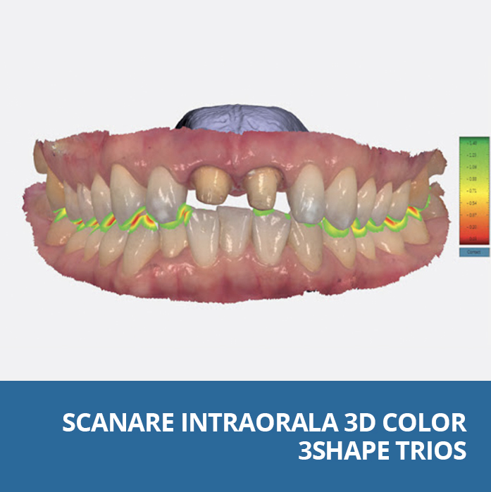 scanare intraorala 3d color 3shape trios