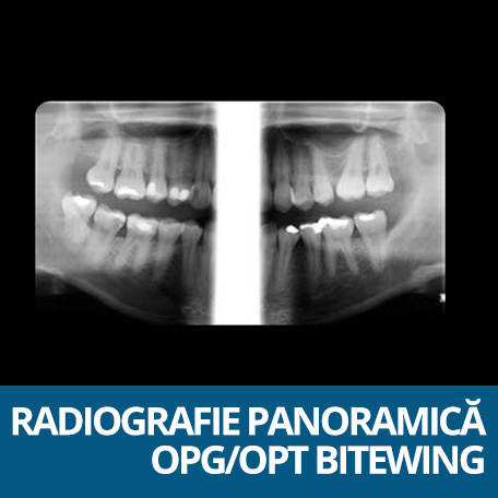 radiografie panoramica bitewing